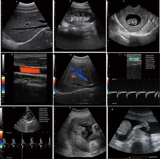 scan izithombe