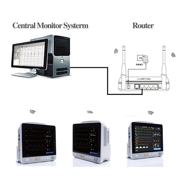 China Modular Patient Monitor Machine in ICU CCU Manufacturer and ...