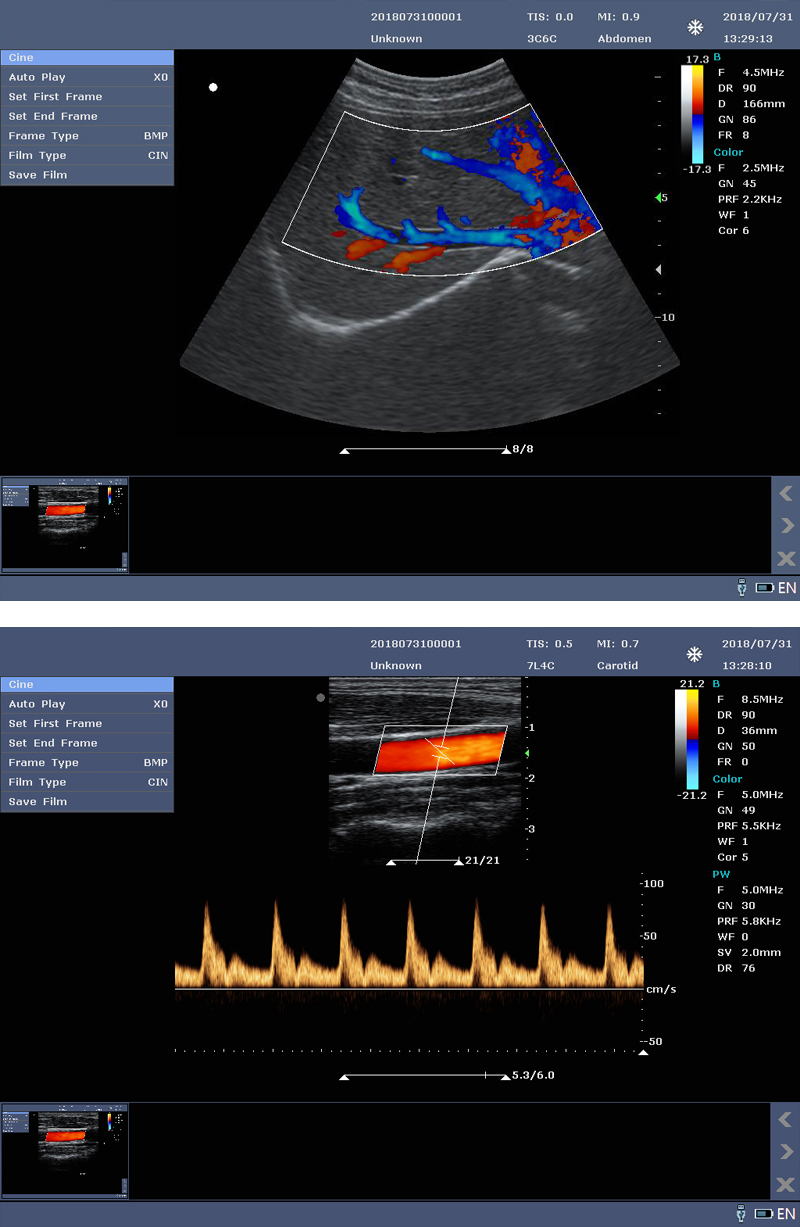 ultrasound machine price