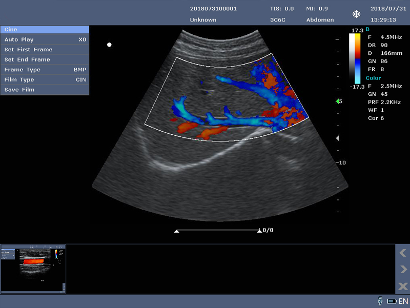 liver ultrasound machine