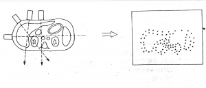 B Ultrasonografie