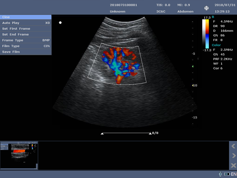 fingertip machine for ultrasound