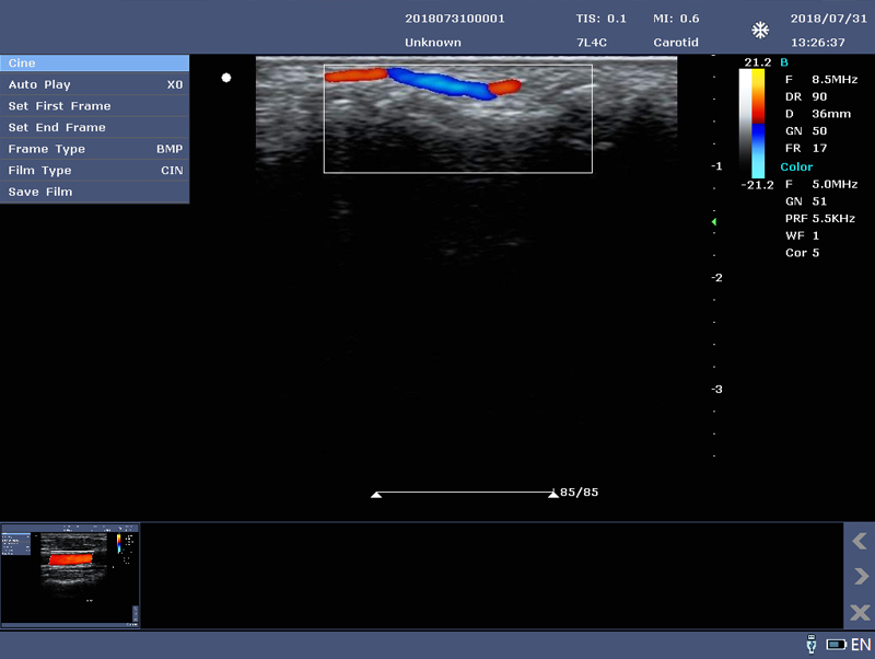 fingertip machine for ultrasound