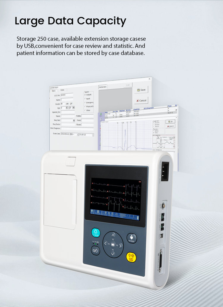 China New PE-E3B Portable ECG Monitor Manufacturer and Supplier | Yonker