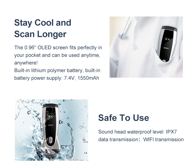 Wireless Handheld USB WiFi Color Doppler Ultrasound  yonker healthcare pk