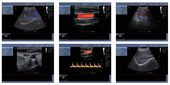 ultrasound machine