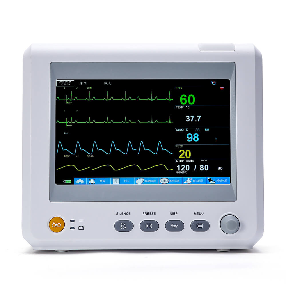 etco2 monitor price