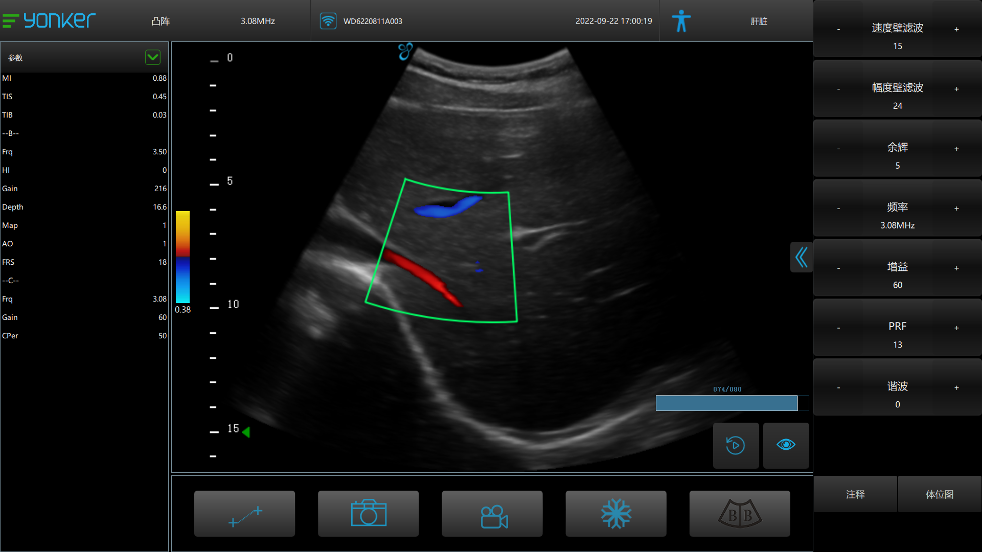 liver scan