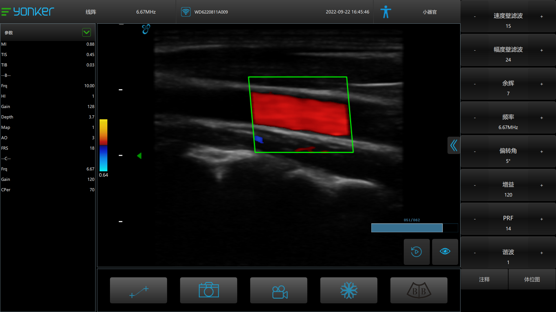 vessal scan