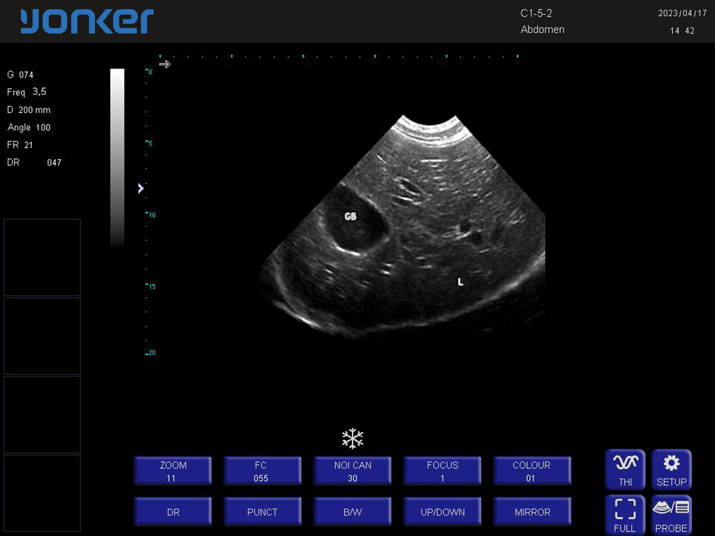 狗-凸阵-B模式-肝脏胆囊 Convex Probe-B Mode-Liver and Gallbladder