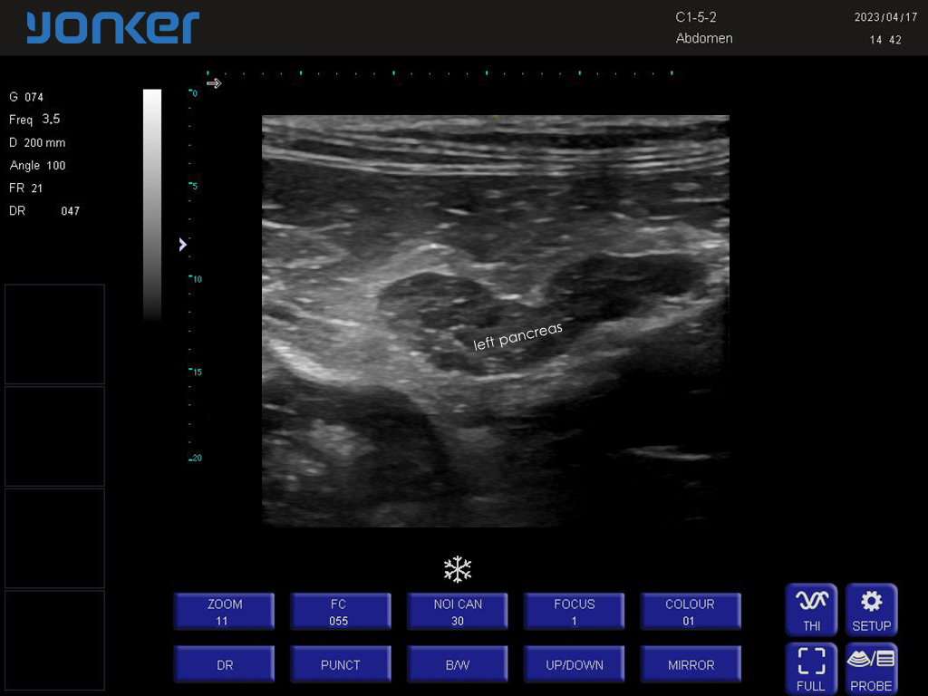 狗-凸阵-B模式-胰腺 Convex Probe-B Mode-Pancreas