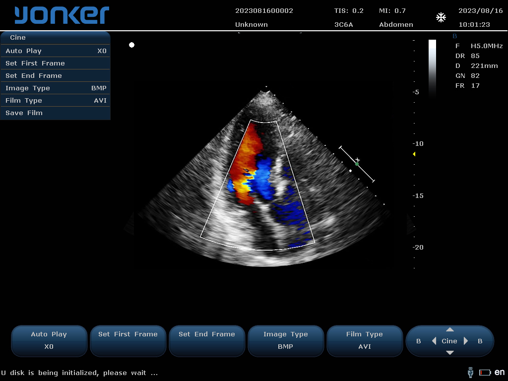 相控阵探头-彩色多普勒模式-心脏 Phased Array Probe-Color Mode-Cardiac2