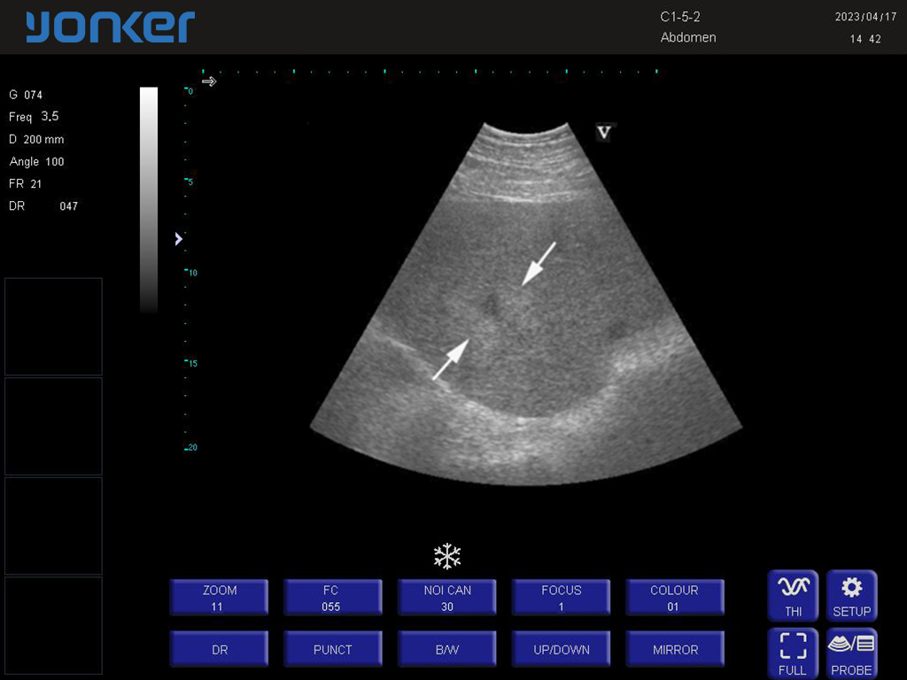 马-凸阵-B模式-脾脏脏 Convex Probe-B Mode- Spleen