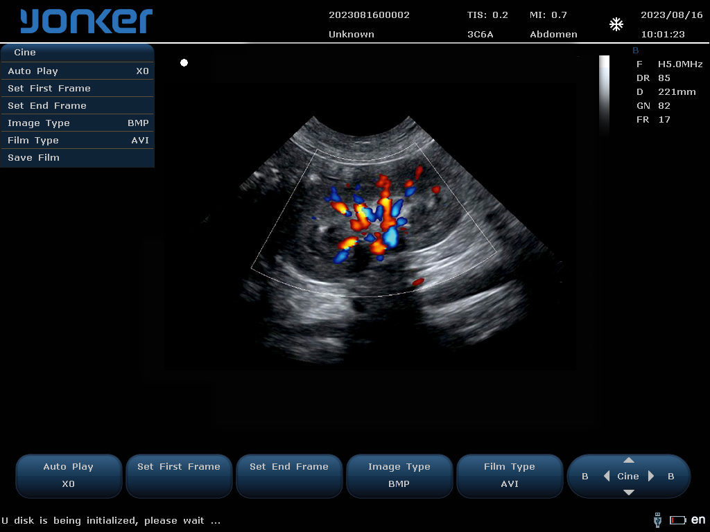 （狗）微凸探头-彩色多普勒模式-肾脏 mikrokonvexe Sondenfarbe Doppler-Modus-Kidney