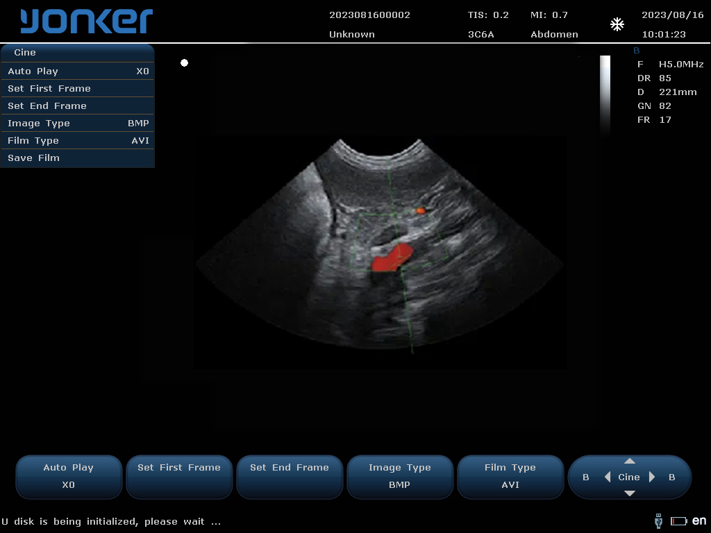 （狗）微凸探头-彩色多普勒模式-脾脏 Micro-convex Probe-Color Doppler Mode-Spleen