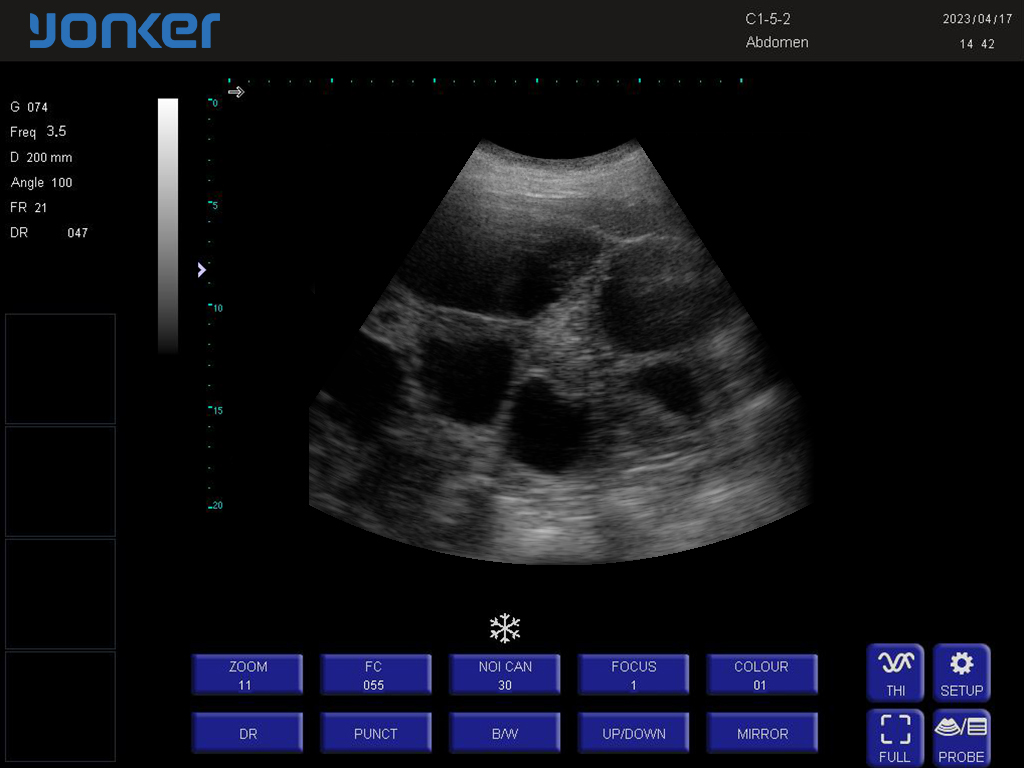 （猪）凸阵探头-B模式-子宫受孕 Convex Probe-B Mode-Uterus2