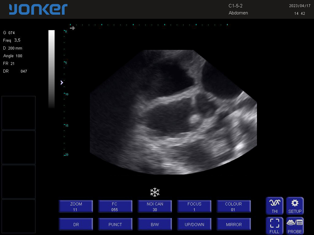 （猪）凸阵探头-B模式-子宫受孕 Convex Probe-B Mode-Uterus2