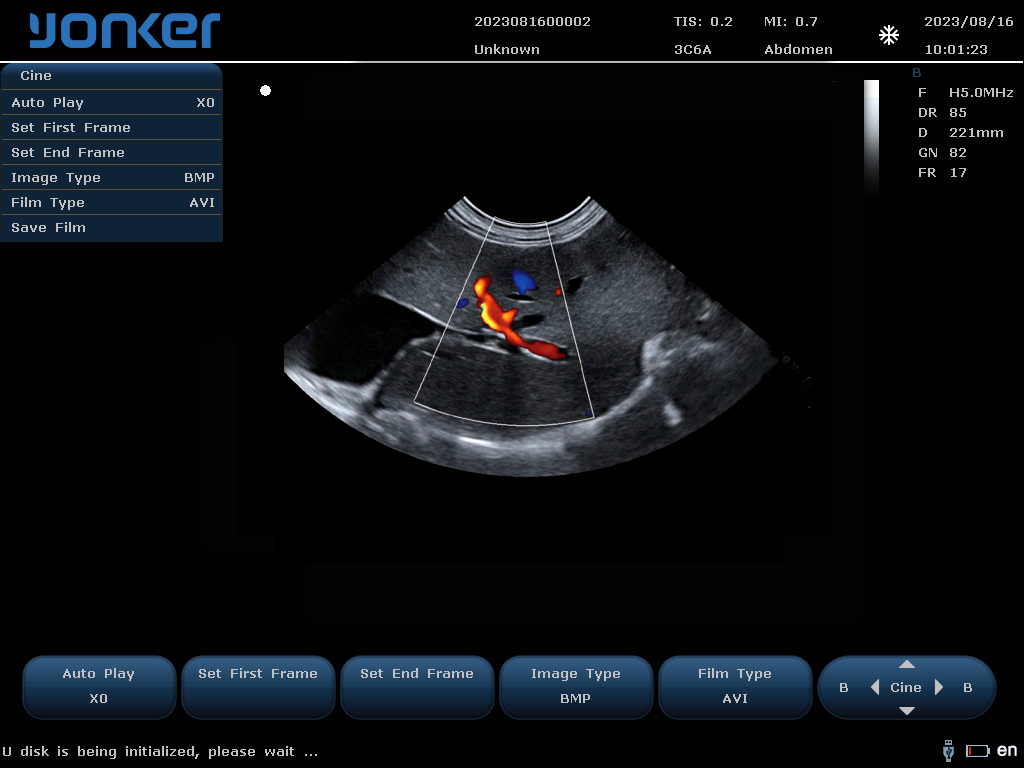 （猫）微凸探头-彩色多普勒模式-肝脏 Micro-convex Probe-Color Doppler Mode-Liver