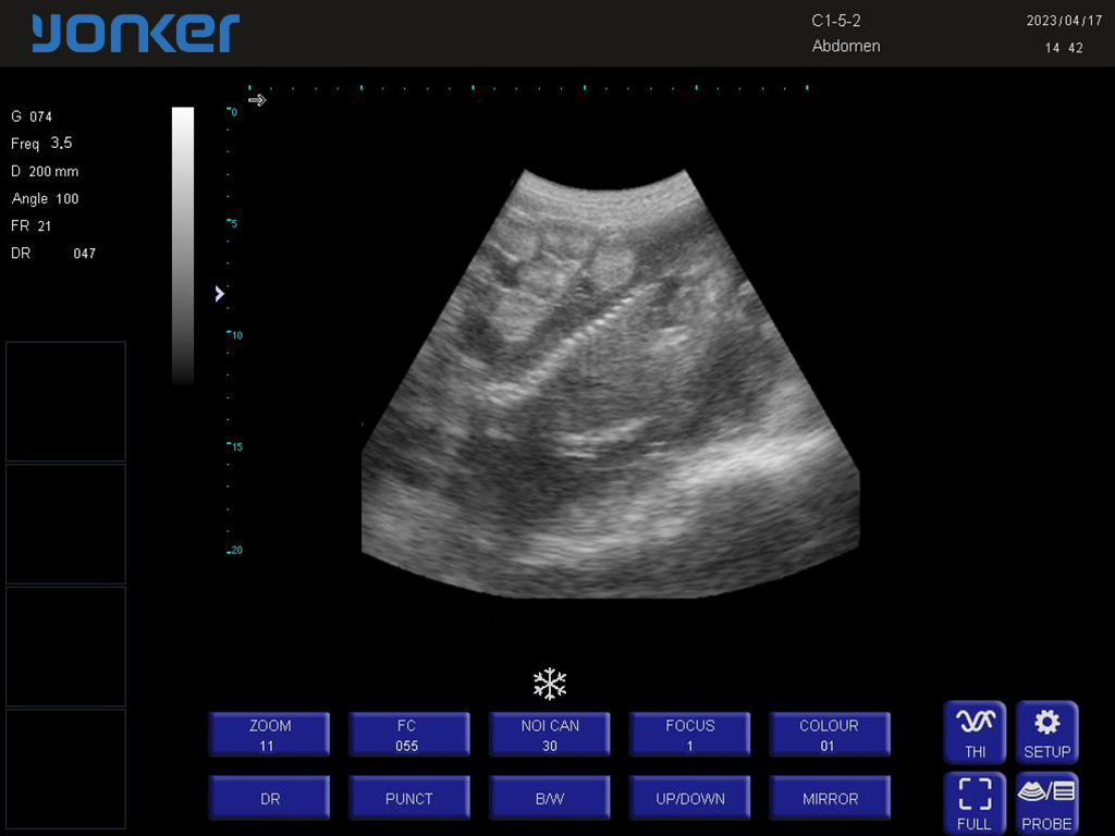 （羊）凸阵探头-B模式-腹部 Convex Probe-B Mode-Abdomen